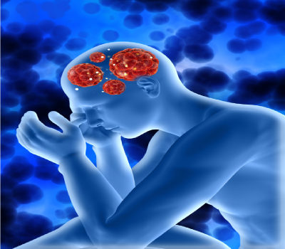 Brain Stroke Treatment in Nanded