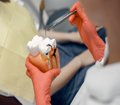 Root Canal Treatment in Nanded