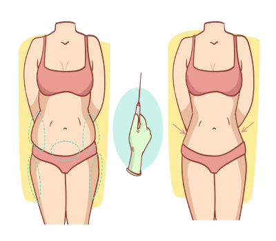 Liposuction Treatment in Nanded